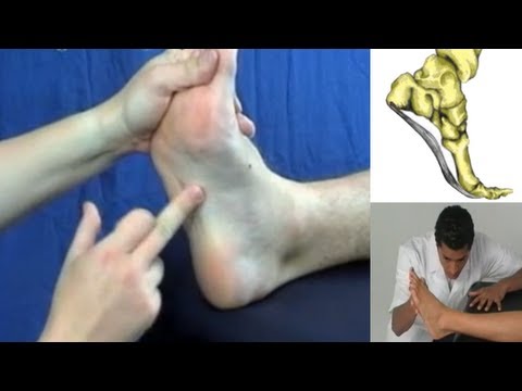 Plantar Fasciitis explained in a minute - including treatment.