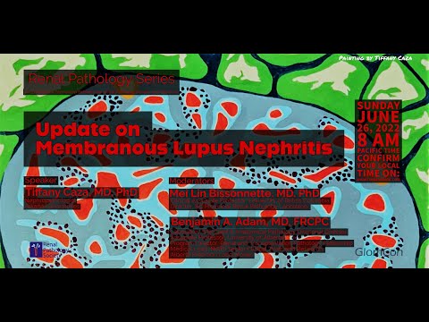 Update on Membranous Lupus Nephritis