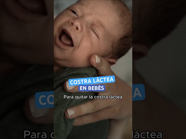 Vídeo relacionado con LABORATORIOS BABÉ - Champú Costra Láctea Pediátrico 200 ml | Champú para bebé y Niños | Regula Producción de Sebo y Elimina la Descamación | Champú Farmacia para el Cuero Cabelludo de Bebés y Niños