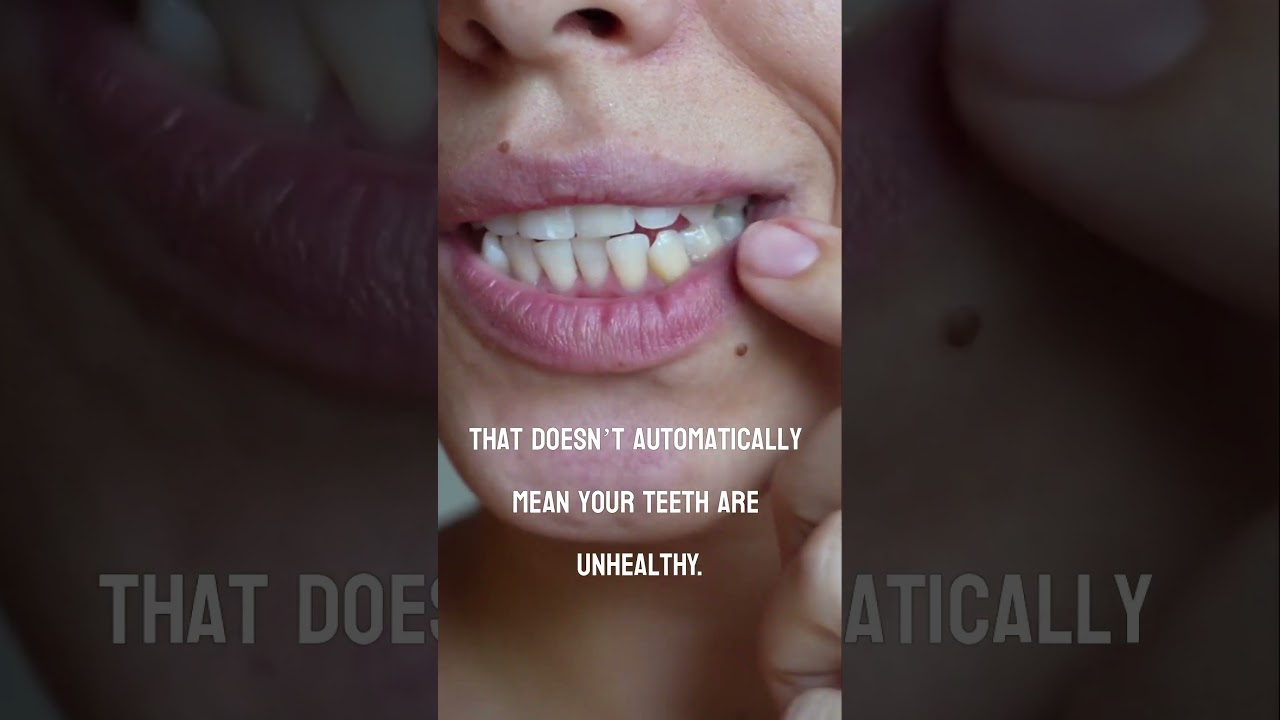 Why Are My Teeth Yellow Even Though I Brush Every Day?