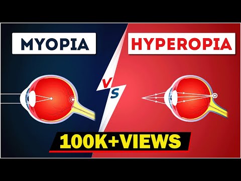 otthoni megelőzés és kezelés: myopia hyperopia