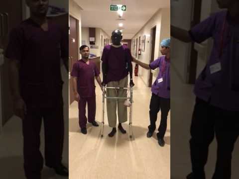 Osteosarcoma Of Proximal Femur (South Sudan) — Patient Video