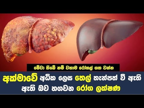 අක්මාවේ අධික ලෙස තෙල් තැන්පත් වී ඇති බව හගවන රෝග ලක්ෂණ - How to Have a Healthy Liver