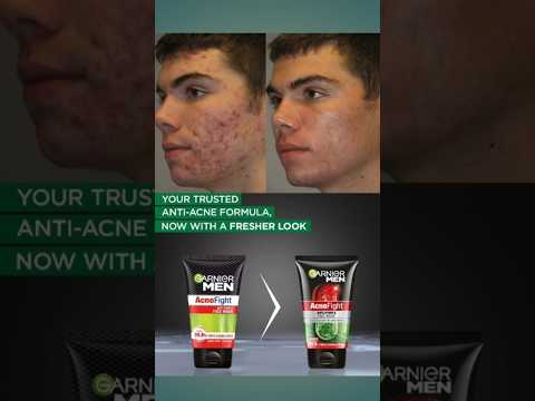 acno fight face wash uses #trending #shorts #beauty