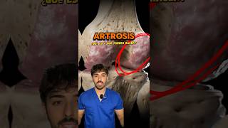 ❗️QUE ES LA ARTROSIS❗️ #deporte #fisio #tips #dolordearticulaciones #dolorderodilla #anatomia #doc