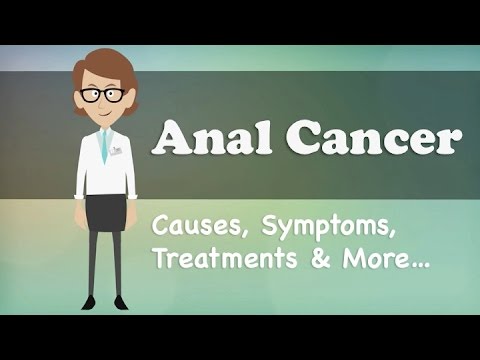 Anal Cancer - Causes, Symptoms, Treatments & More…