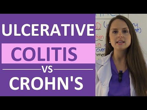 Crohn's Disease vs Ulcerative Colitis Nursing | Crohn's vs Colitis Chart Symptoms, Treatment
