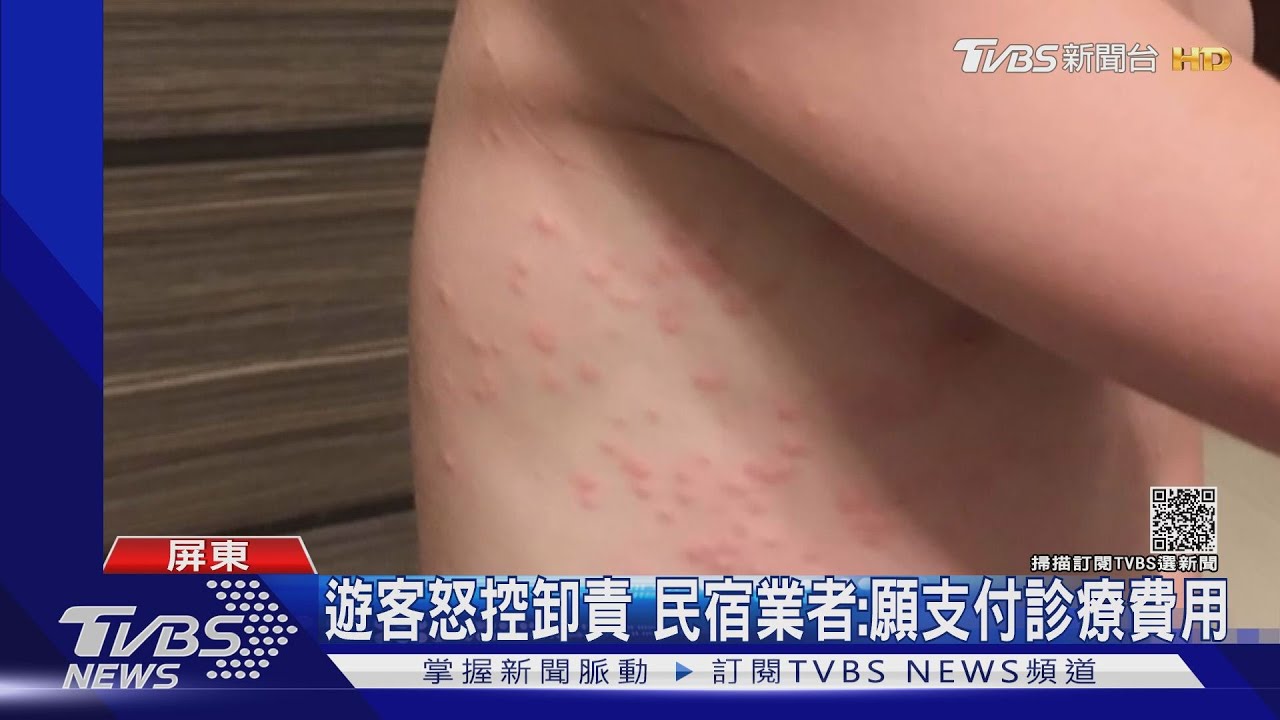 全身紅腫發癢!遊客控民宿不乾淨 業者:毛毛蟲引發