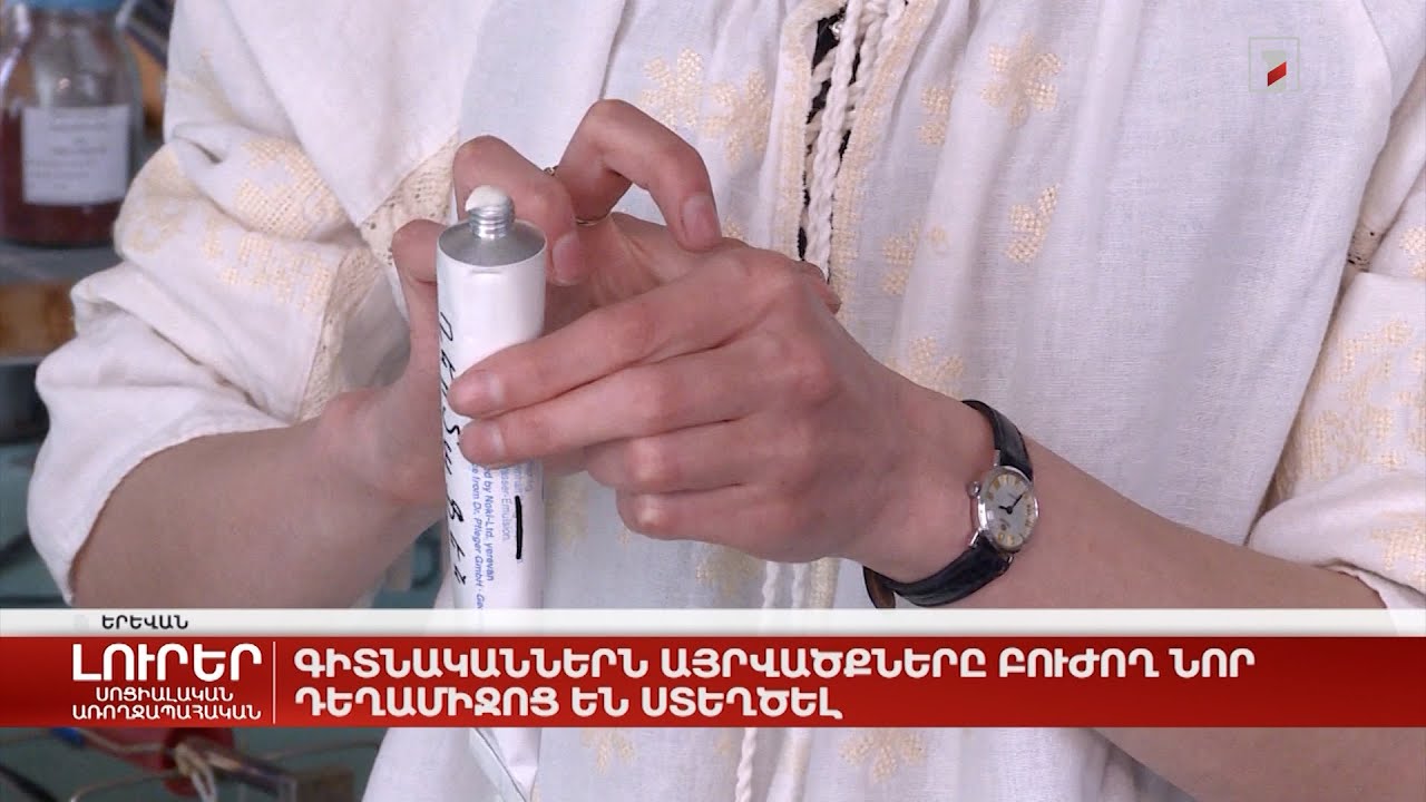 Գիտնականներն այրվածքները բուժող նոր դեղամիջոց են ստեղծել