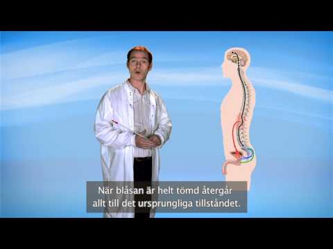 LoFric - introduktion till ren intermittent kateterisering för män, del 2