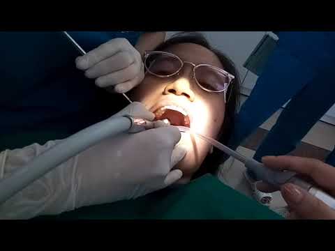 Dental Check Up and Painful Drilling on Woman