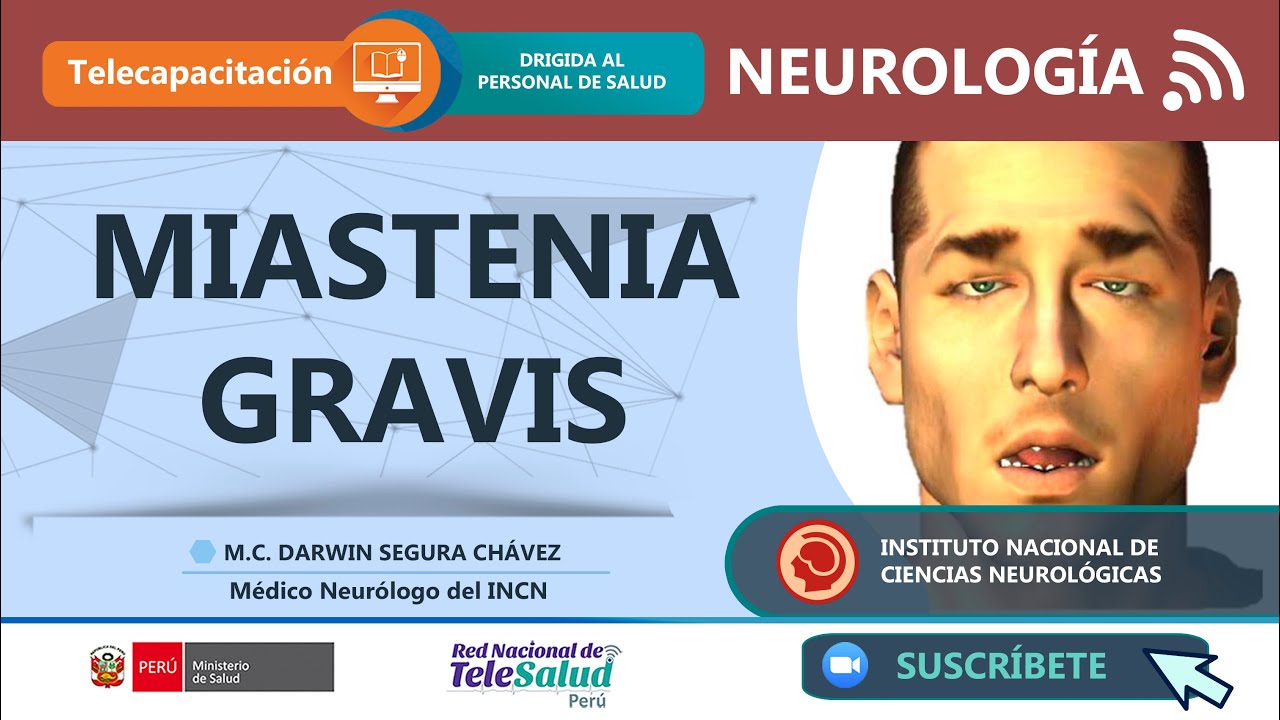 MIASTENIA GRAVIS - DIAGNÓSTICO Y TRATAMIENTO