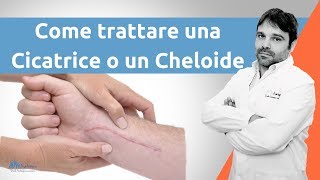 Come trattare una cicatrice cheloide