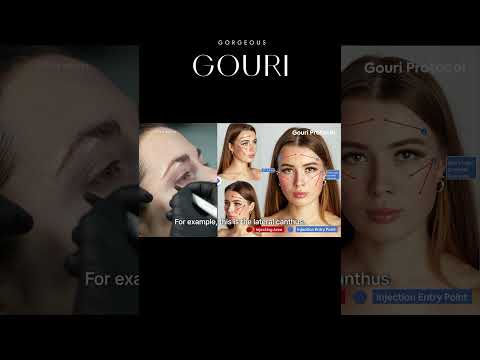 GOURI Injection Design: What Not to Do