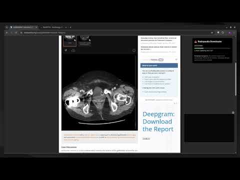 Item video thumbnail