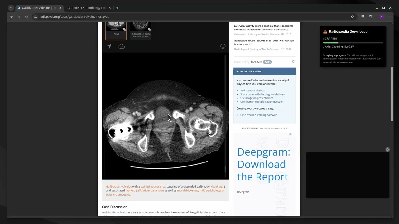 Import Radiopaedia Cases