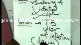 general pathology 19 : TUBERCULOSIS 3 DR SAMEH GHAZY