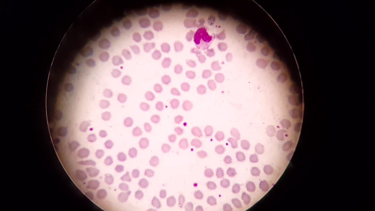 Putar video Trombosit dan Eritrosit sekarang Trombosit dan Eritrosit