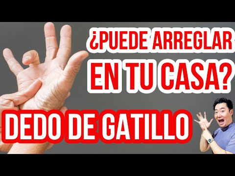 ¡Prevención del dedo de gatillo! ¡Hazlo antes de cirugía! Autoestiramiento para reducir el dolor.