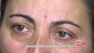 Սուր անկյուն 22.02.2026 - Քնարիկ Պետրոսյան «Վախի ու ցավի արանքում»