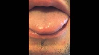 Tongue twitching - BFS