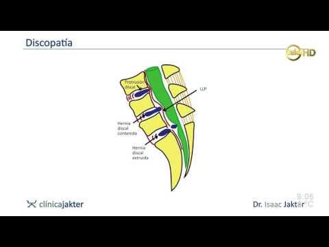Fa ALMAG 1 con ernia intervertebrale Osteocondrosi bassa emoglobina