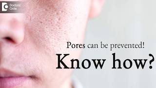 How to prevent pores on face? - Dr.K.C. Nischal | Doctors