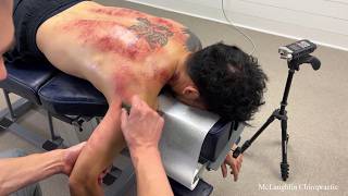 Difficult NECKS & Spines Get *CRACKED* Two Cases - TIGHT NECKS CAUSE PAIN & DECREASED ROM
