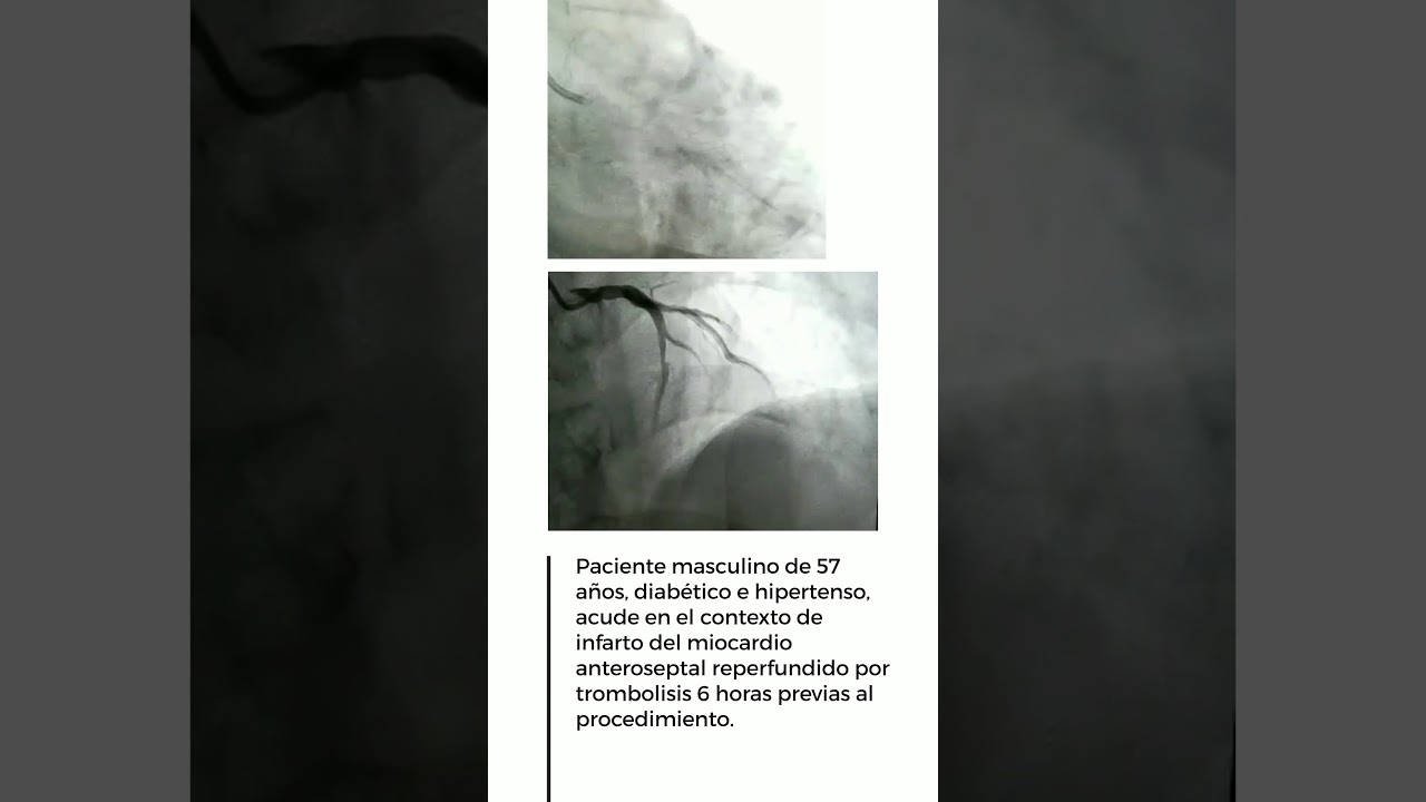 Héctor Hugo Escutia Cuevas-19