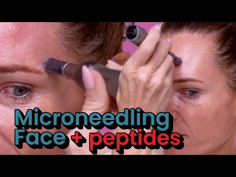 Microneedling Face With Dr. Pen M8S + Aquashine | Peptide-Powered Skin Glow Live