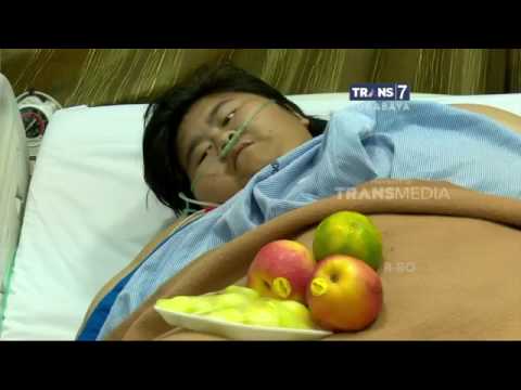 9 produk pelangsing Cara menurunkan berat badan dengan cepat di rumah dengan 20 sampai