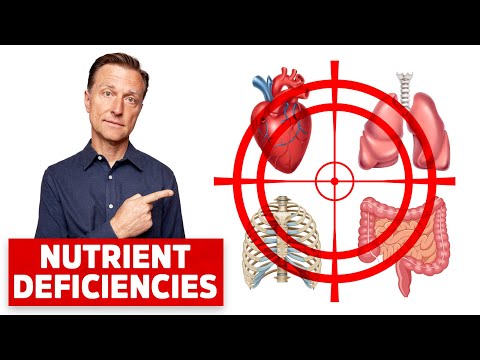 Dr Berg Explains What Makes you Feel Sick Despite Eating Healthy Food