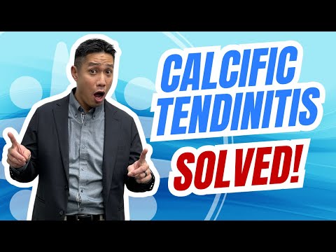 Your Stubborn Shoulder Pain Might Be Calcific Tendinitis—Here's What Works