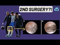 Expert Explains Jakub Moder Injury Update: 2nd Surgery & New Details