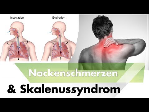 Osteochondrose in Tabelle Gelenke Behandlung von Alkohol-Tinktur cinquefoil