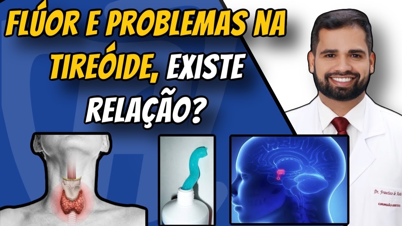 Francisco De Assis Almeida Lima Júnior-126