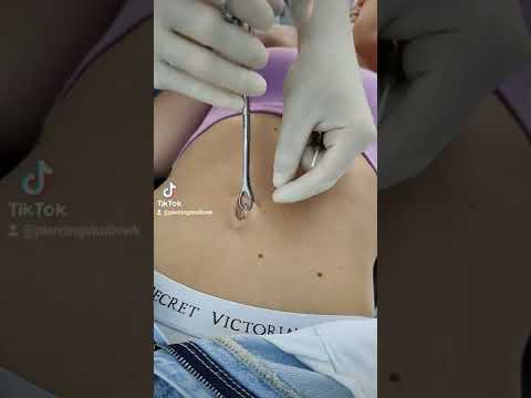 Anna bekommt ein 🔥 Bauchnabel Piercing 💉 #PiercingStudioWermelskirchen #piercing #girl #tiktok
