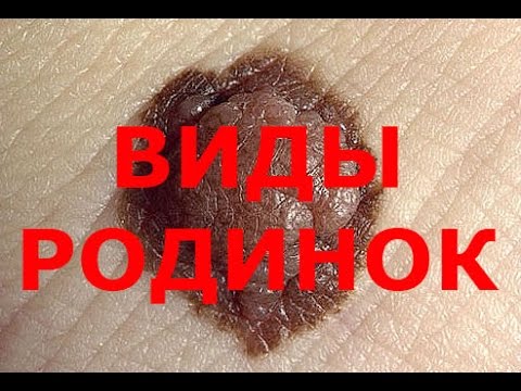 Коленный сустав гель Суставы лечение не дорого