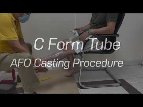 C-Form Tube AFO Casting - Marlo Ortiz, CPO