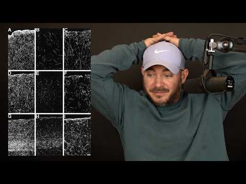 I made a mistake. I'm sorry.