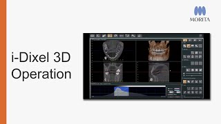 Learn how to use i-Dixel's 3D functions with confidence. 