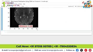 Brain Tumor Prediction and Segmentation Using CNN
