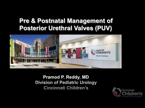 12.14.2020 Urology COViD Didactics - Pre & Postnatal Management of Posterior Urethral Valves (PUV)