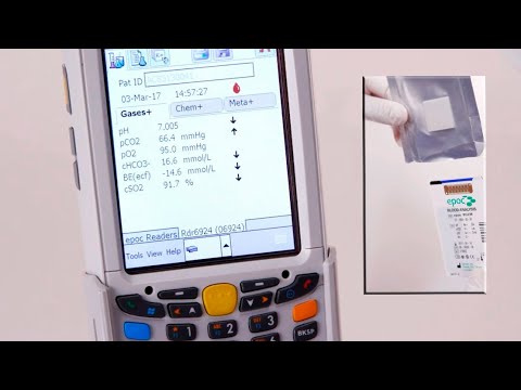 Epoc Blood: gasometría portátil e inalámbrica.