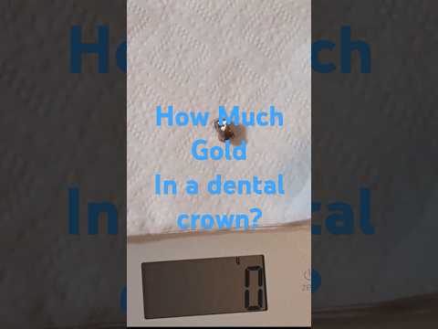 How much gold in a dental crown?