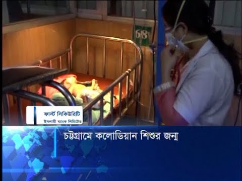 চট্টগ্রামে বিরল বৈশিষ্ট্য নিয়ে জন্ম নিয়েছে এক শিশু | ETV News