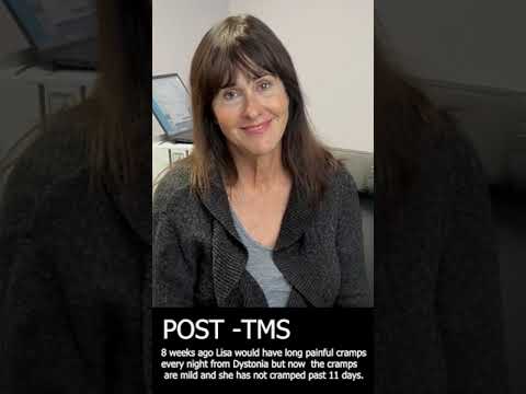 TMS Therapy Before and After - Lisa Bryant