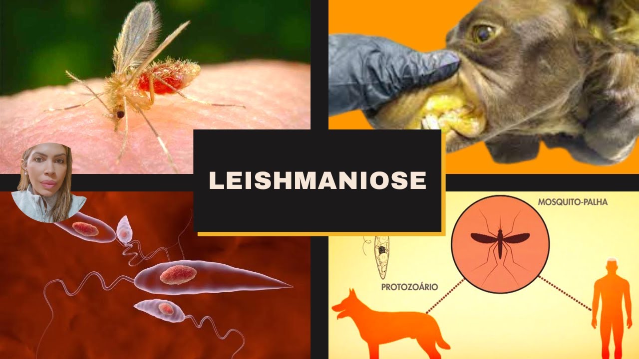 Leishmaniose