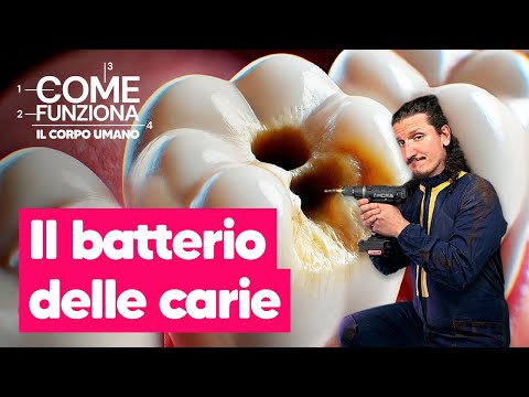 Lo zucchero fa venire le carie? Ecco COSA SUCCEDE DAVVERO ai tuoi denti