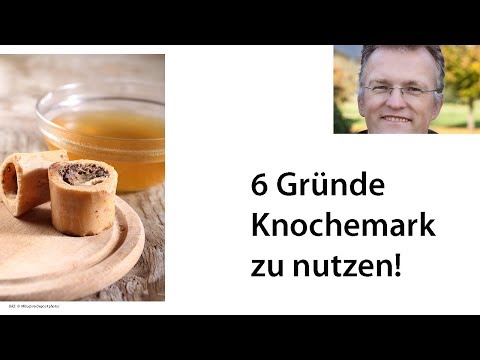 Rückenschmerzen welche maz Quoten für die Knieendoprothetik Moskau